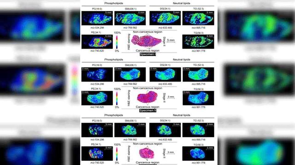 Chemical Snapshots and Molecular Maps with Mass Spec Imaging content piece image