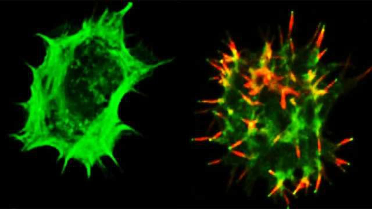 ‘Homing System’ Targets Therapeutic T Cells to Brain Cancer