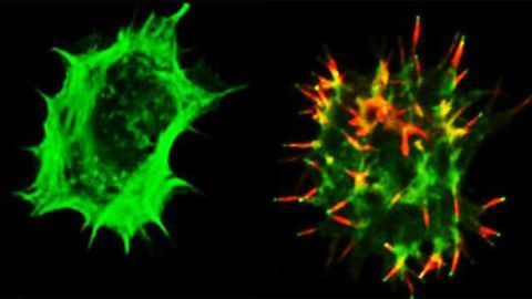 ‘Homing System’ Targets Therapeutic T Cells to Brain Cancer