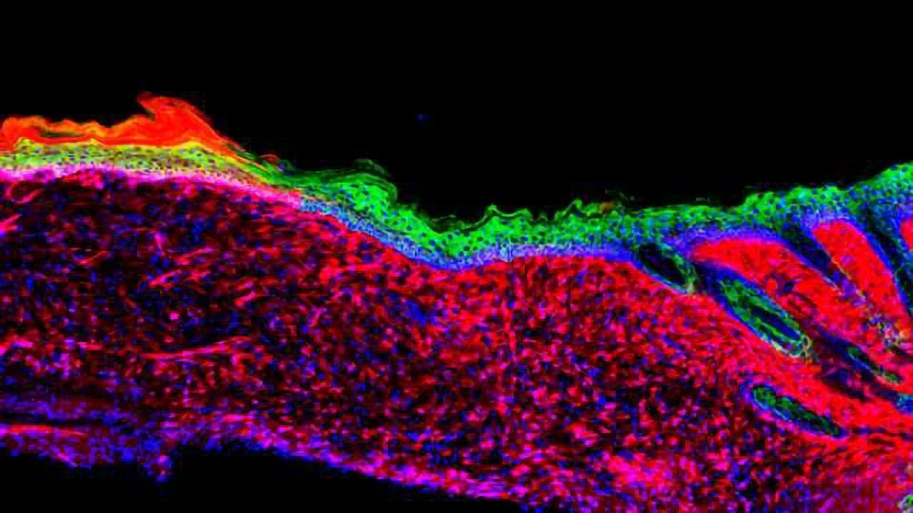 Resident Wound Cells Reprogrammed into Skin Cells