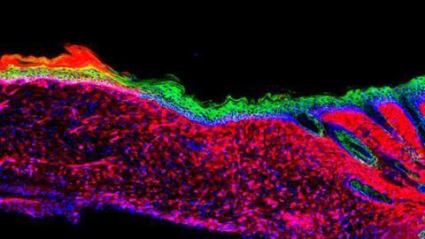 Resident Wound Cells Reprogrammed into Skin Cells