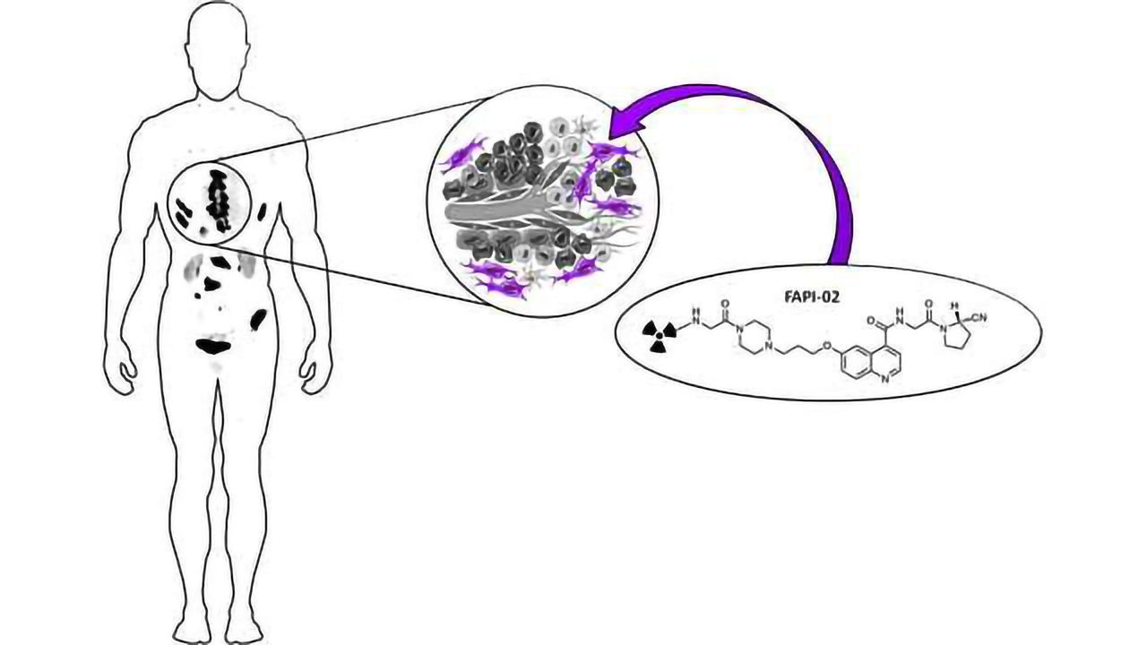 New Nuclear Medicine Imaging Method for Tumor ID Offers Improved Contrast