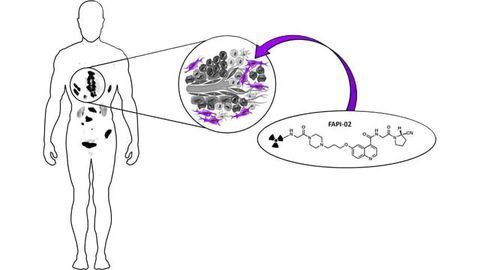 New Nuclear Medicine Imaging Method for Tumor ID Offers Improved Contrast