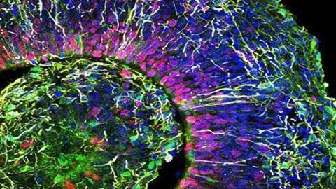 Building a Better Brain-in-a-Dish, Faster and Cheaper
