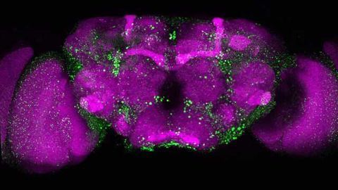 Minute Fiber Formation Precedes Huntington's disease