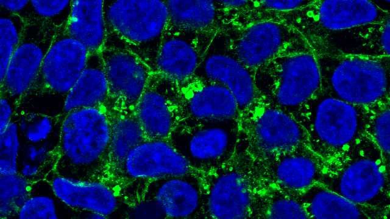 Stray Proteins Cause Genetic Disorders