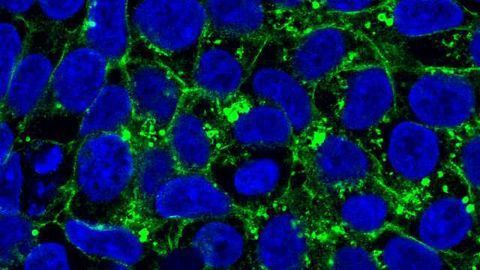 Stray Proteins Cause Genetic Disorders