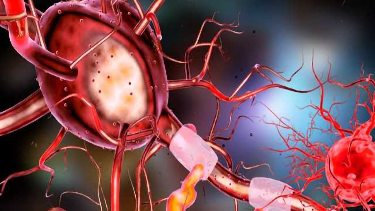 Study Shows How Exercise Generates new Neurons and Improves Cognition in an Alzheimer's Mouse Model