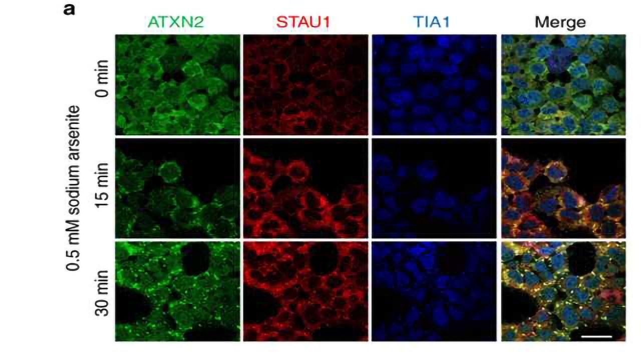 Stifling 'Staufen1' in Cells Improves Motor Function in Neurodegenerative Mice