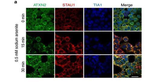 Stifling 'Staufen1' in Cells Improves Motor Function in Neurodegenerative Mice