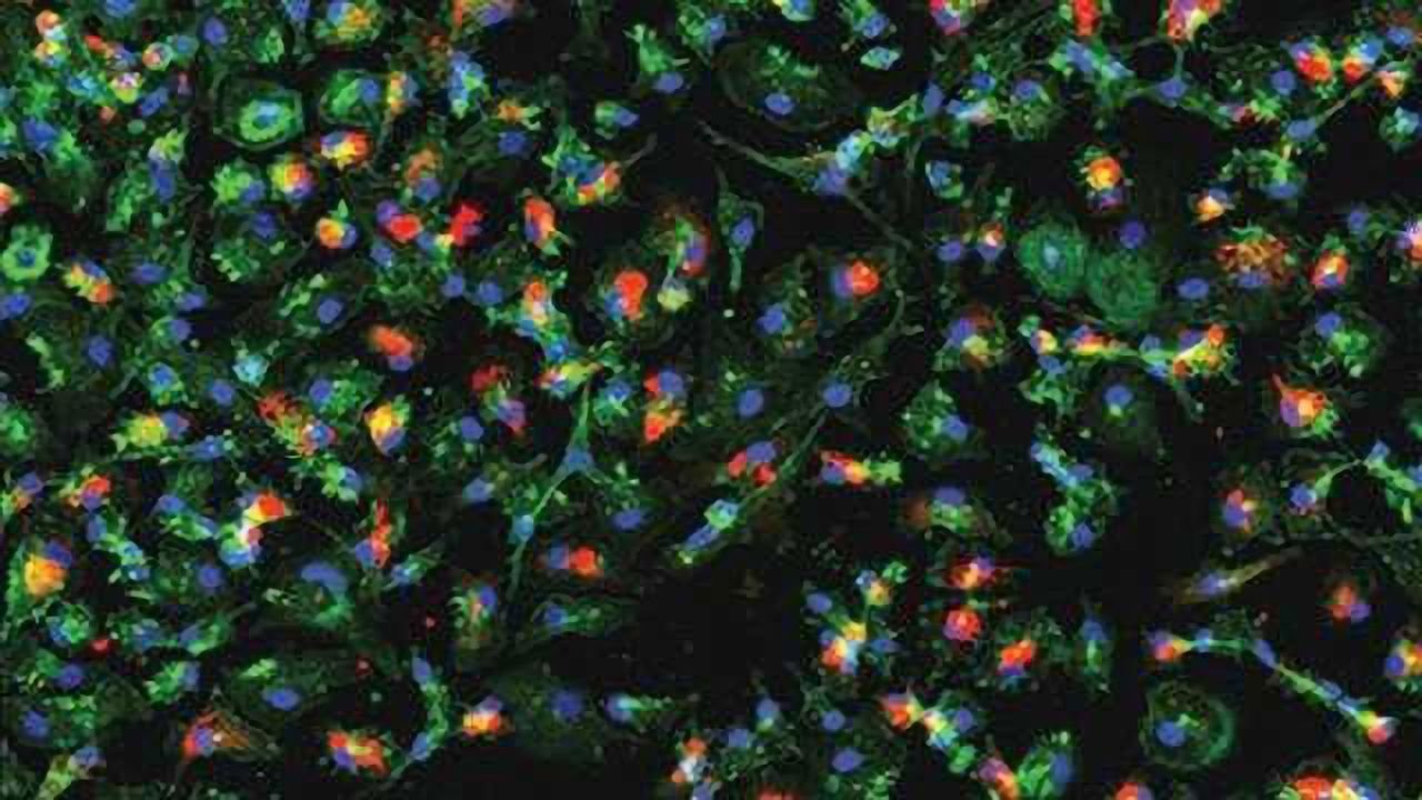 Zika Virus Strips Immune Cells of their Identity