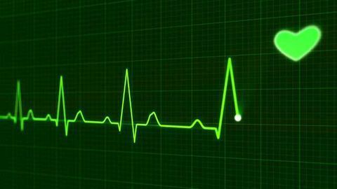 Changes in Mitochondrial DNA Control Severity of Heart Disease