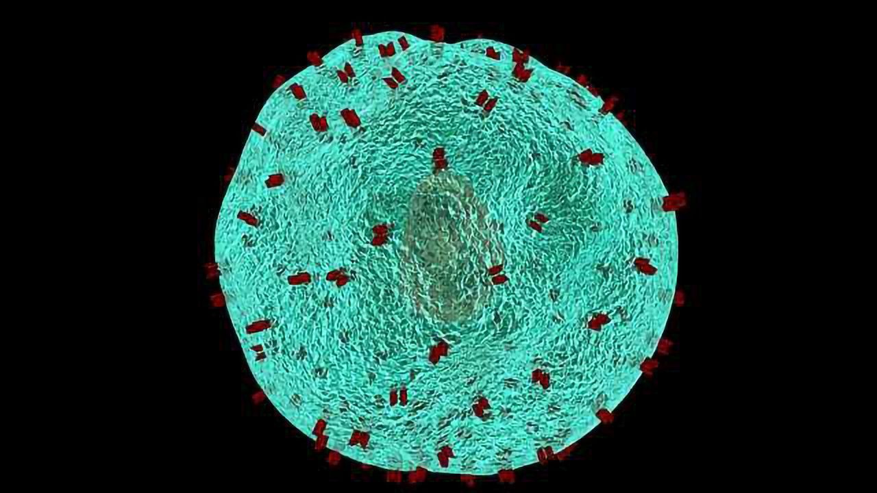 Predicting Response to Immunotherapy in Melanoma