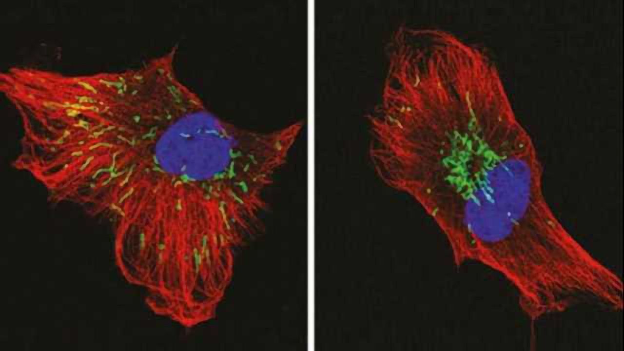 Mitochondria Unite to Fight Cancer Cells