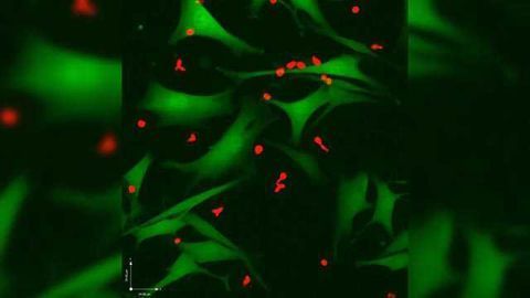 “Signposts” on Cancer Cells May Help Immune Cells Eliminate Melanoma