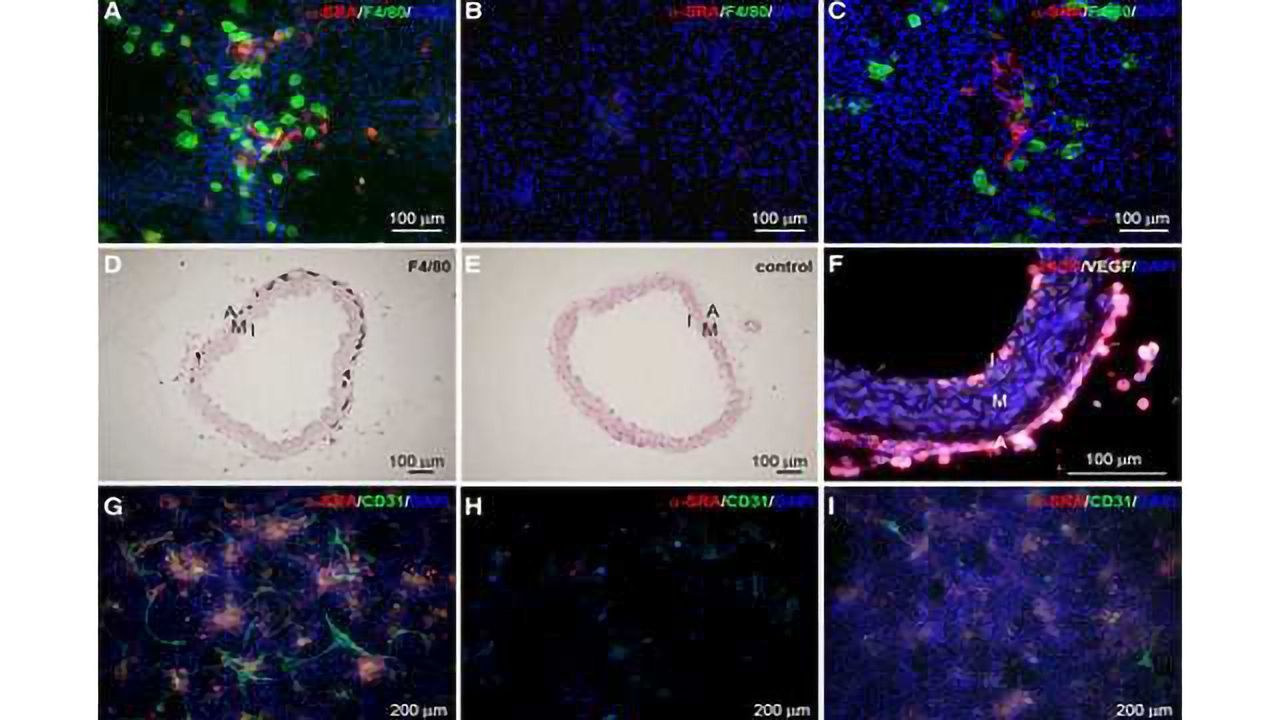 Beating Heart Muscle Cells Derived from Stem Cells