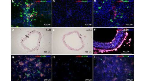 Beating Heart Muscle Cells Derived from Stem Cells