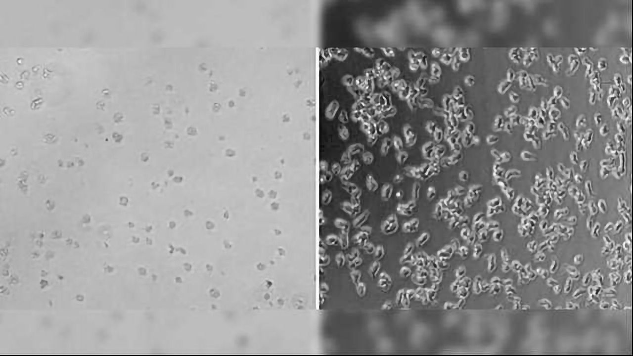 Cancer Drug & Antidepressants Provide Clues for Treating Fatal Brain-Eating Disease