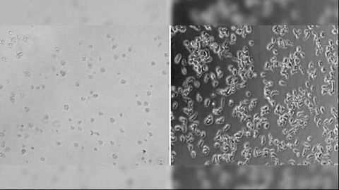 Cancer Drug & Antidepressants Provide Clues for Treating Fatal Brain-Eating Disease