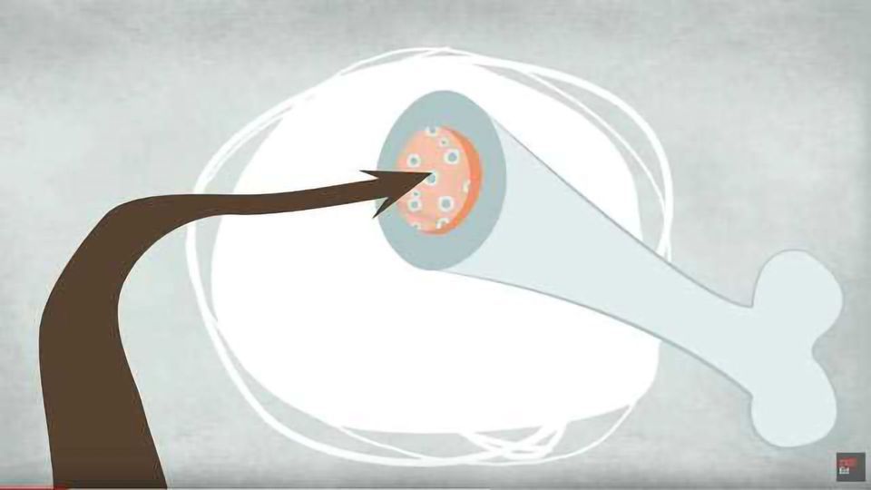 What is Leukemia? content piece image