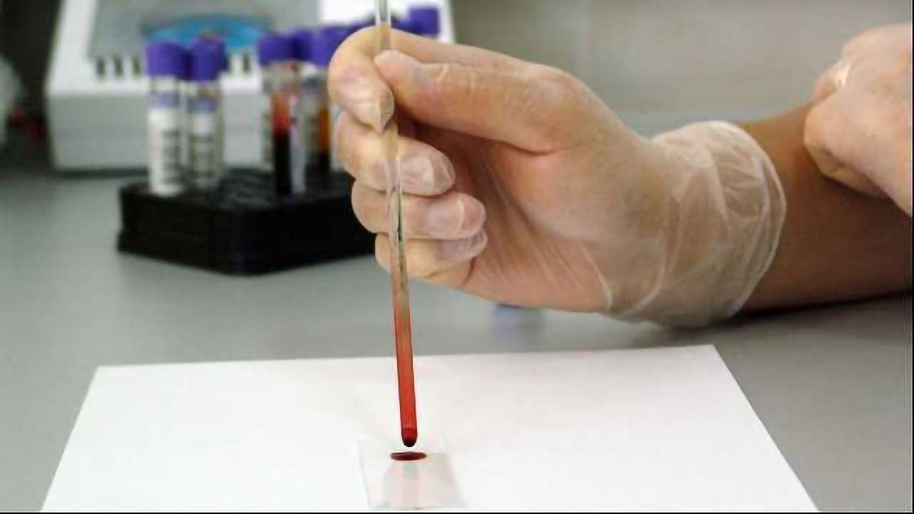 Quantifying Metabolites With a Single Drop of Blood