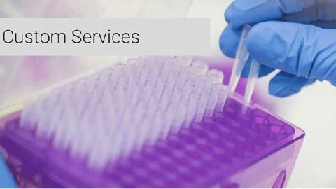 Expedeon AG Announces Commercial-Use Licence of Proprietary Technology in Diagnostic Assay