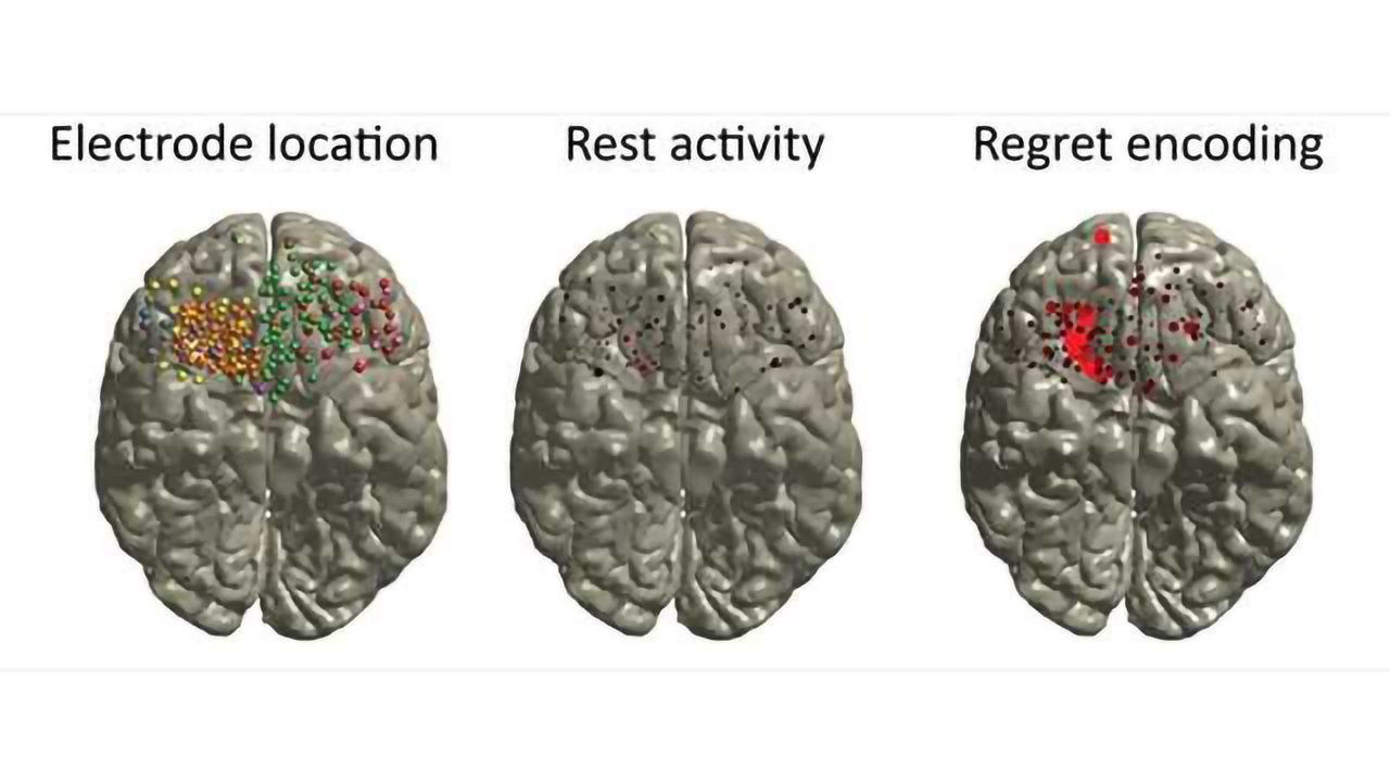 Neuroscience Reveals the Gambler's Curse! -Regret