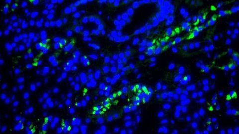 New Biomarkers Help Decipher When Herpesvirus is Active