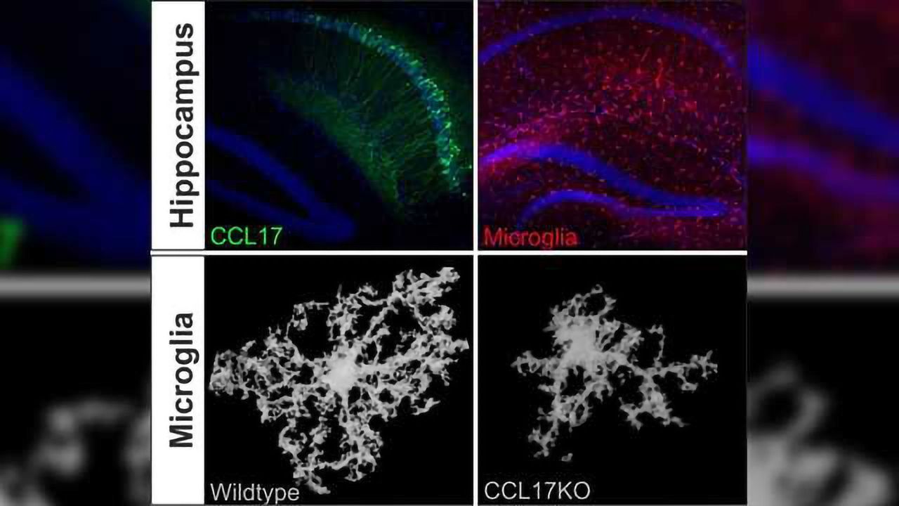 Allergy Driver Influences Brain Cell Communication