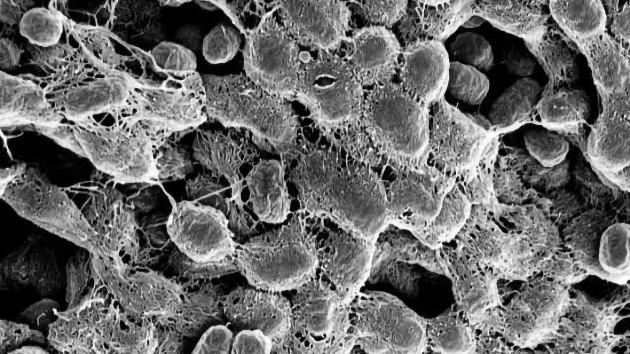 Stuck on You - Targeting Bacterial Adhesion to Reduce Antibiotic Use
