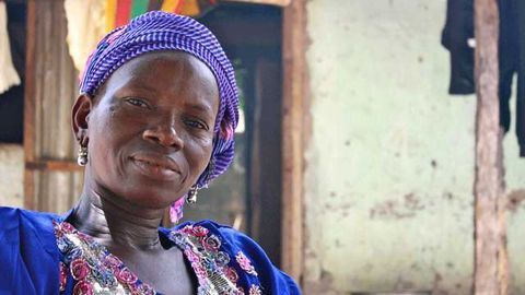 Lupus Antibody Study Should Lead to Better Diagnoses for Black Africans