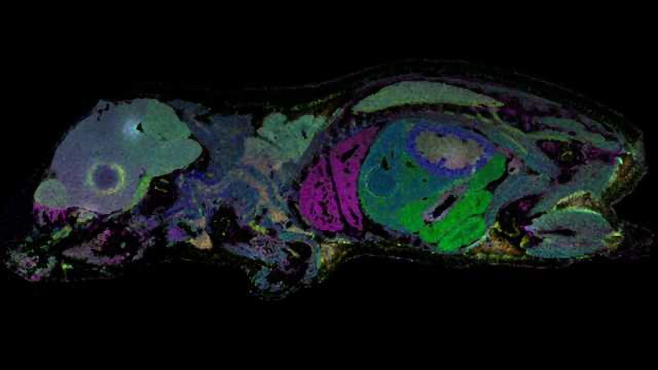 Unlabeled MALDI Molecular Imaging