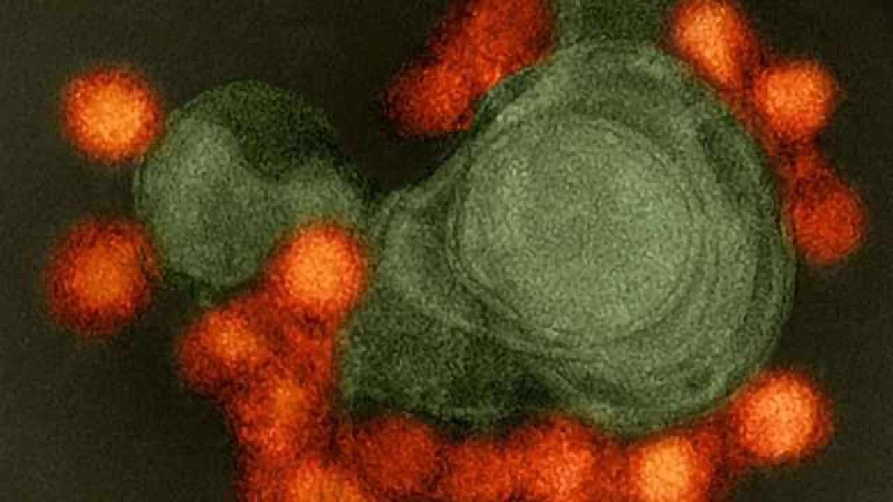 Zika Vaccine Shows Promise For Treating Deadly Brain Cancer