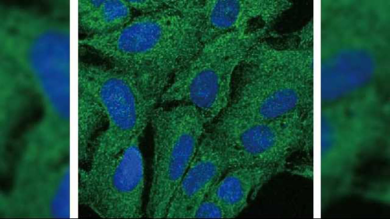Tweaking Cells’ Gatekeepers Could Help Fight Cancer