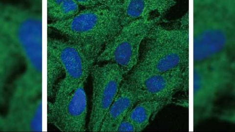 Tweaking Cells’ Gatekeepers Could Help Fight Cancer