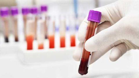 Existing Drug Could Treat Porphyria