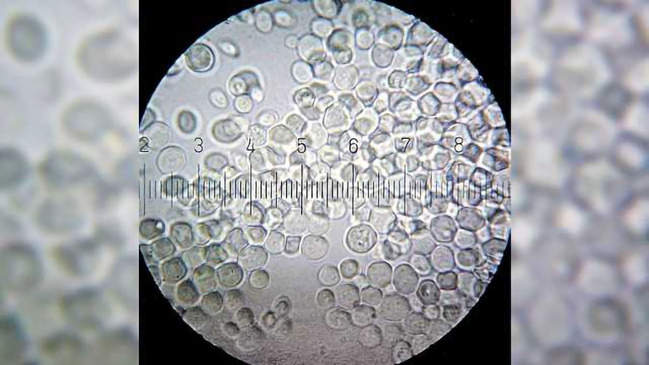 Probing Yeast Cells to Understand Cell Misregulation