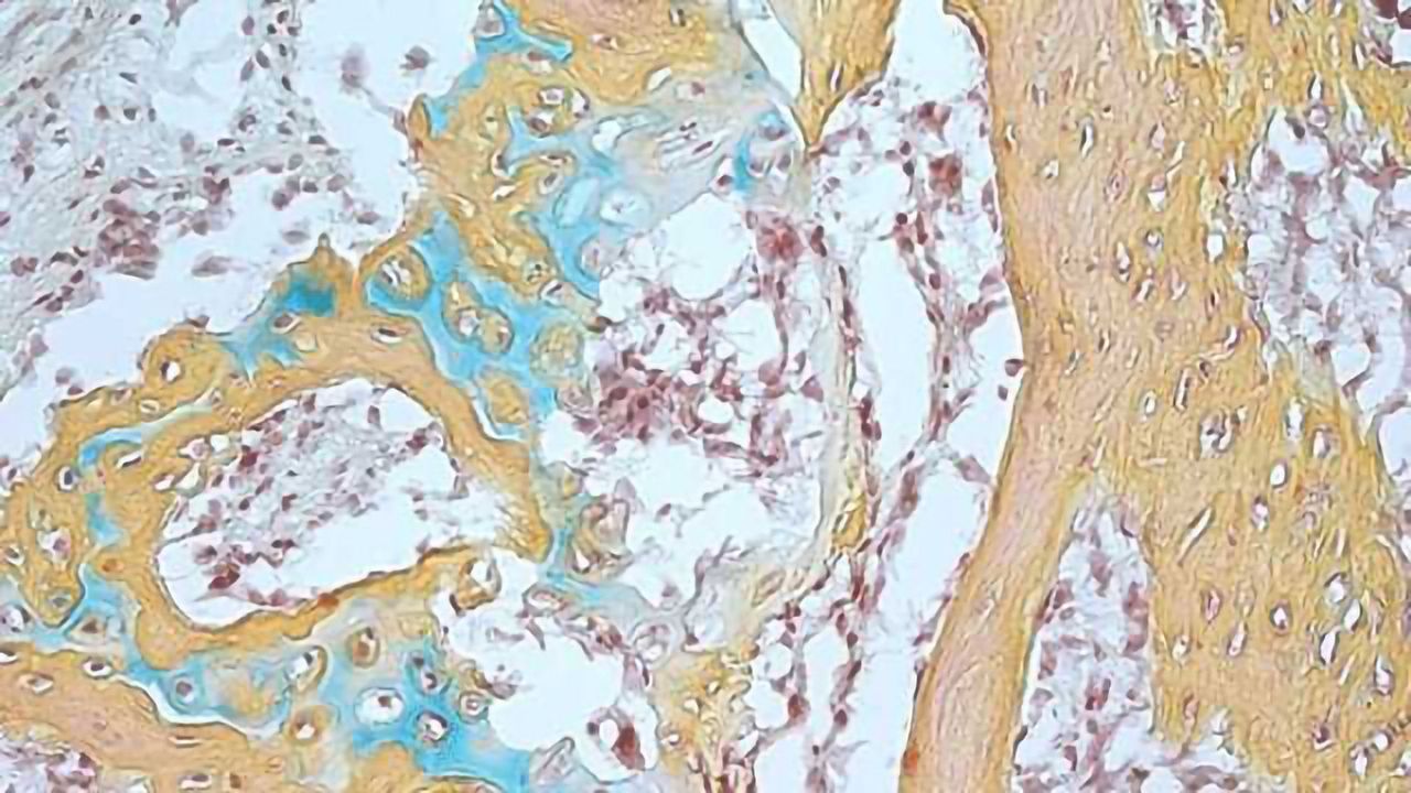 Human Skeletal Stem Cells Isolated for the First Time