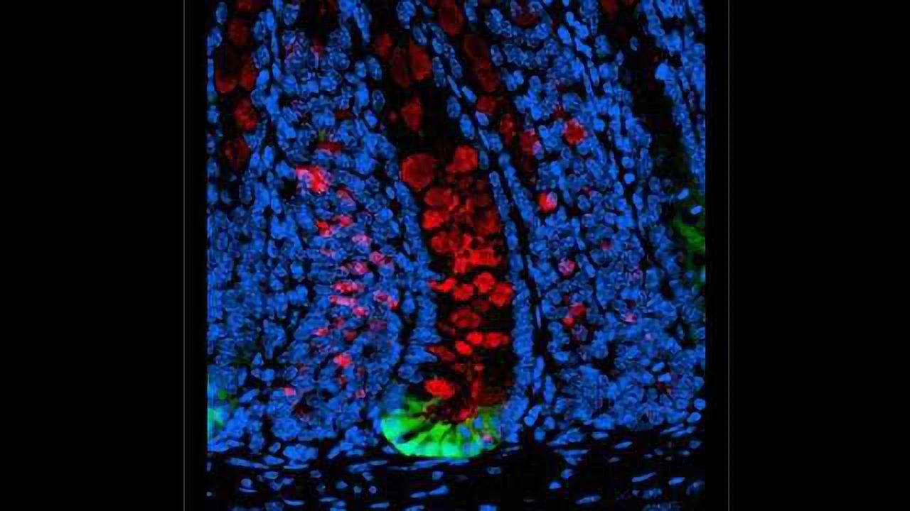 Clinical Prospects for Stem Cells Begin to Emerge