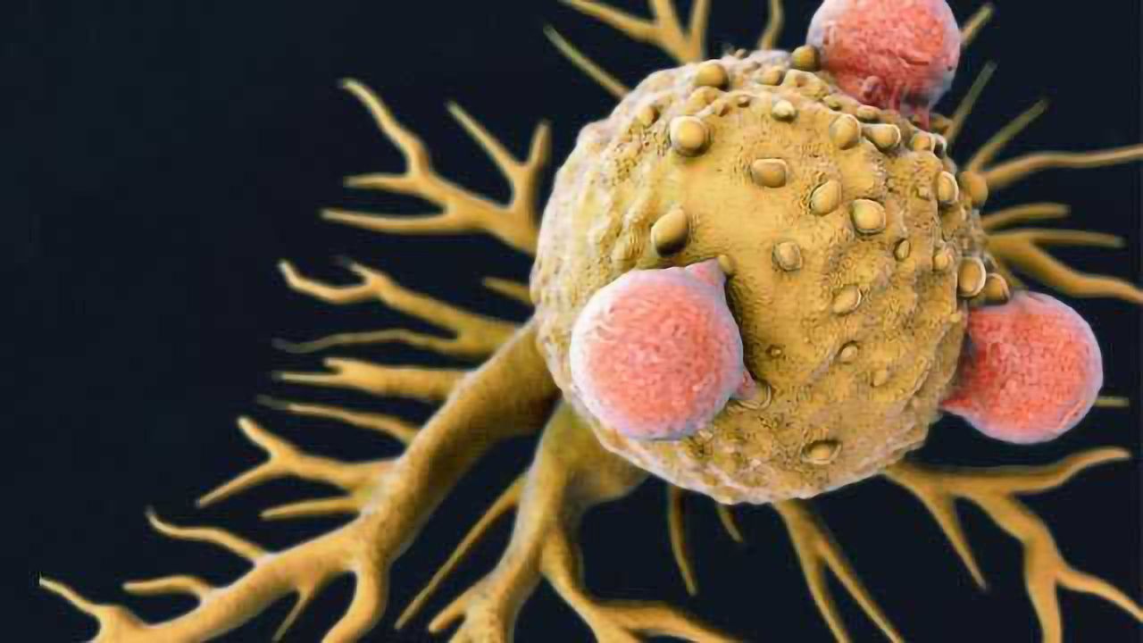 Shaping the Cancer Fight with Immune Cells