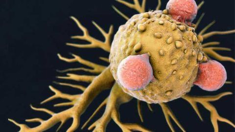 Shaping the Cancer Fight with Immune Cells