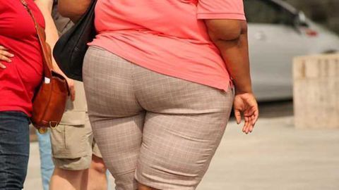 Obesity Set to Overtake Smoking as Biggest Preventable Cause of Cancer