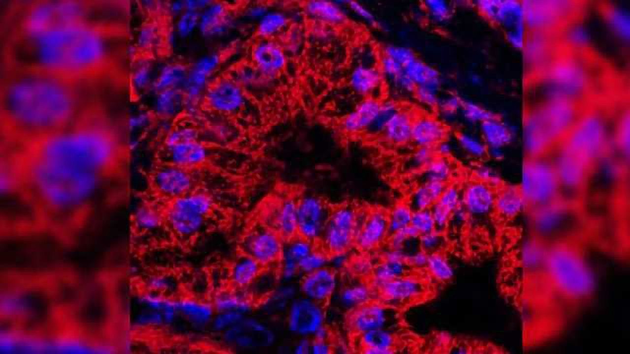 Drug Blocks Pancreatic Cancer Growth in Mice