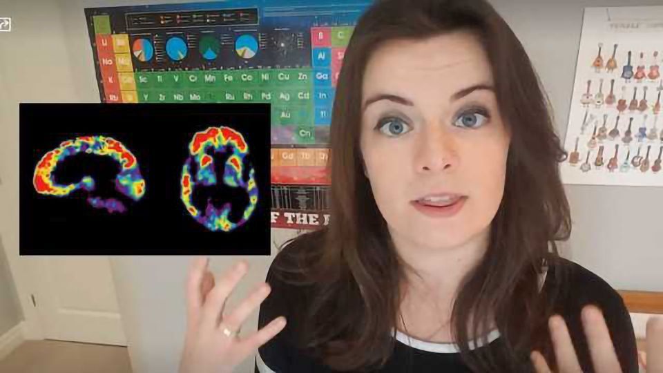 The Biomarkers Which Could be Used to Spot Alzheimer’s Earlier content piece image
