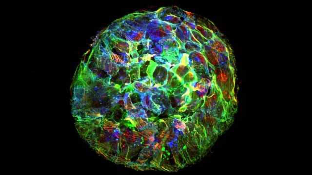 Tumor Cell Metastasis Challenges Laws of Physics