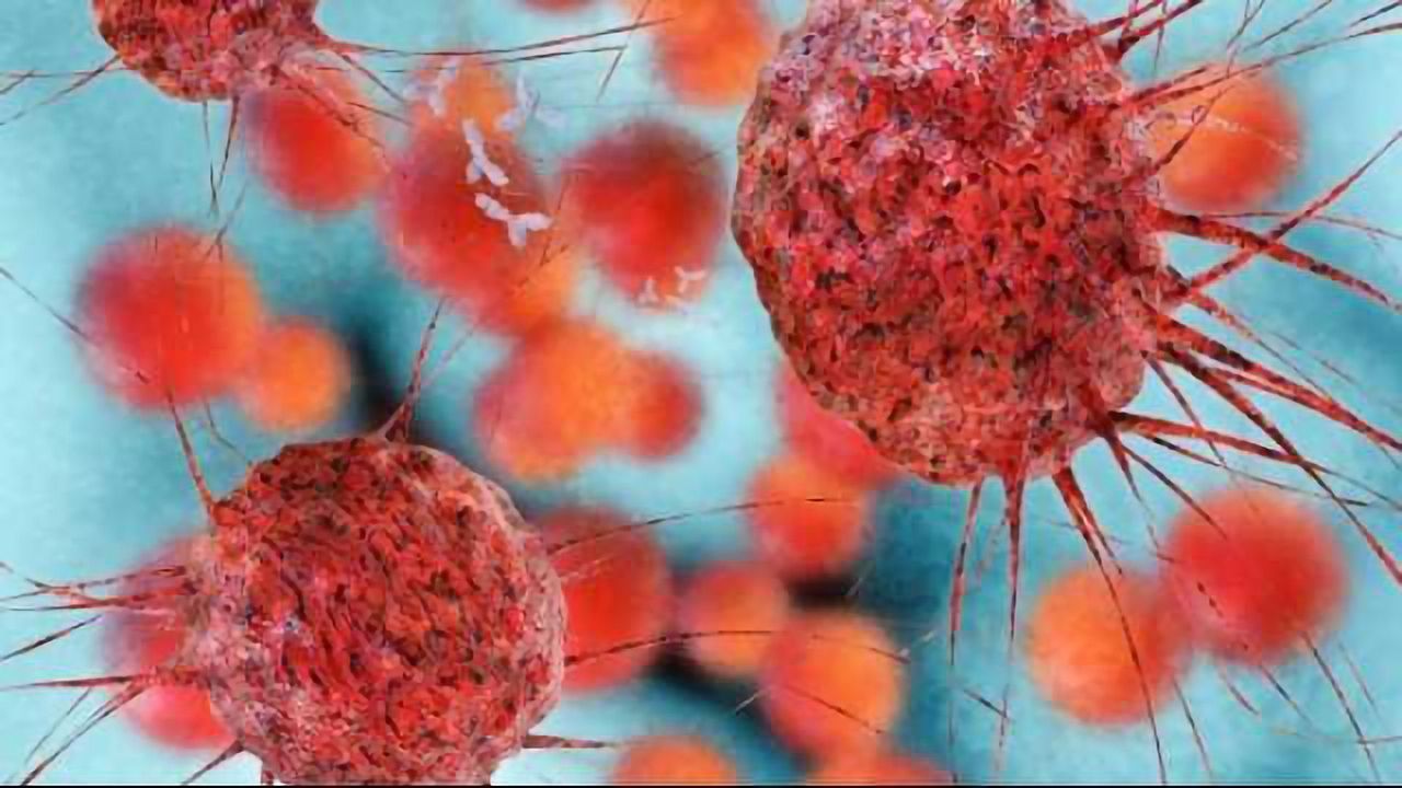 First Patient in the UK Receives Pioneering Form of Radiotherapy