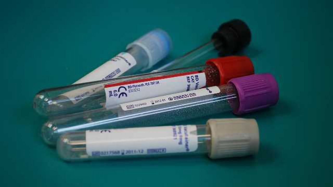 Urine RNA May Provide Muscular Dystrophy Biomarkers