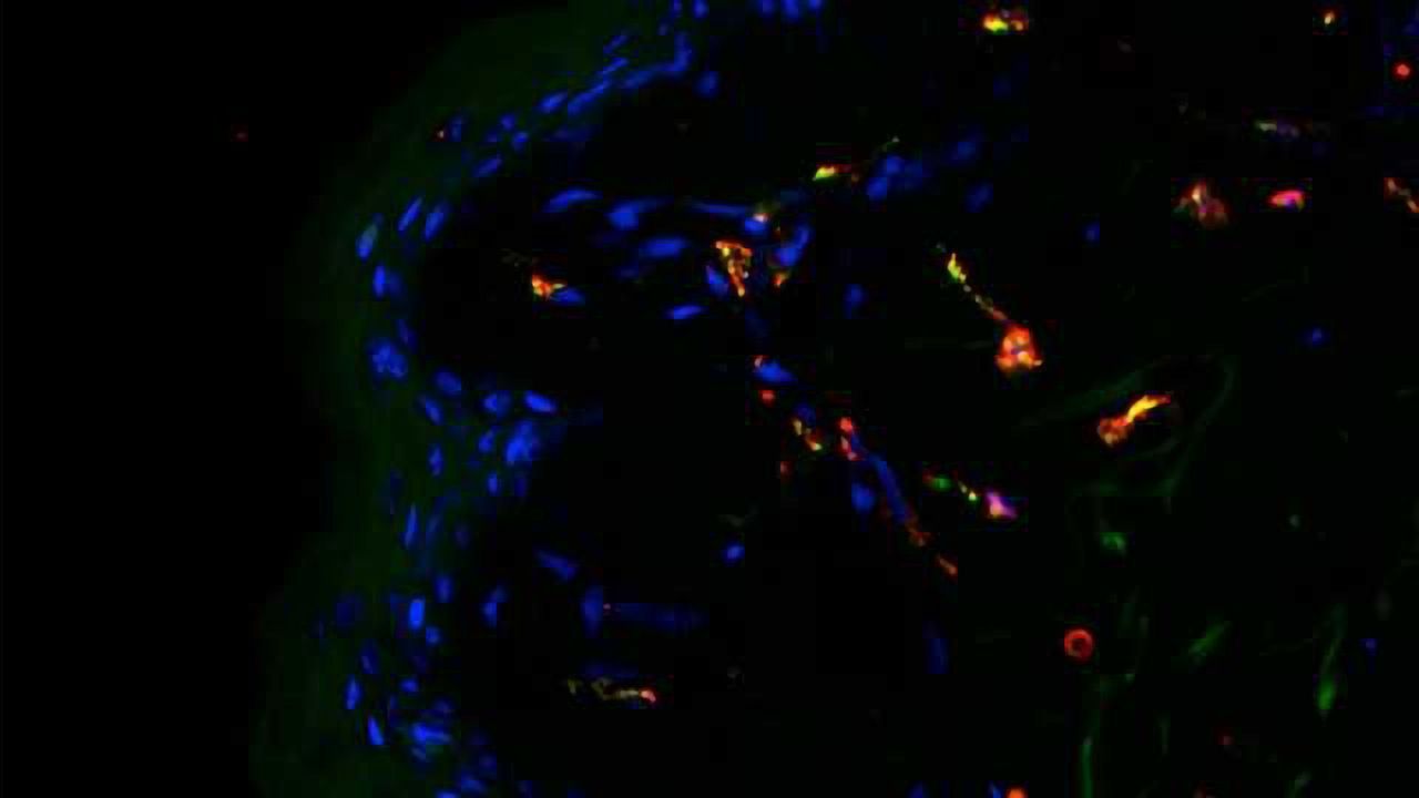 Hayfever Vaccine Improved with Sugar