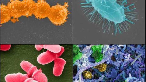 Fecal Microbiota Transplantation Provides Help for Cancer Patients