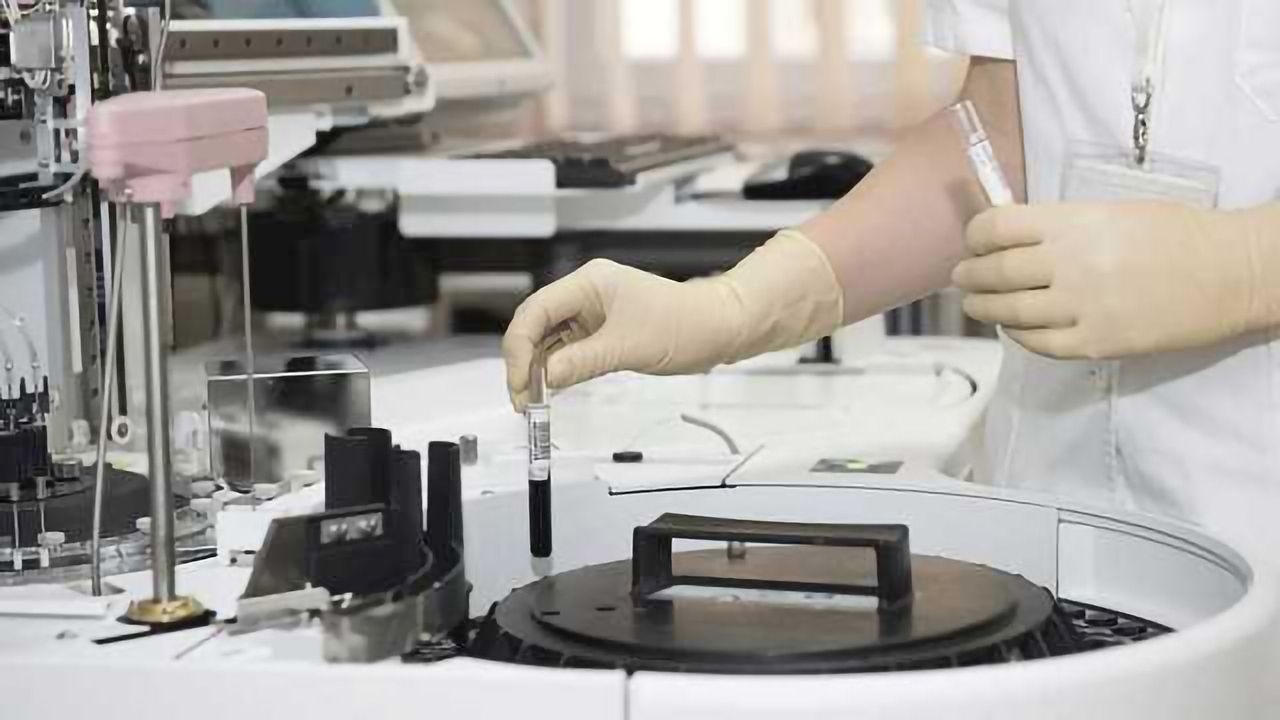 How Transitioning to Automation in the Lab Improves Patient Outcomes